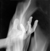 Hand in fire.